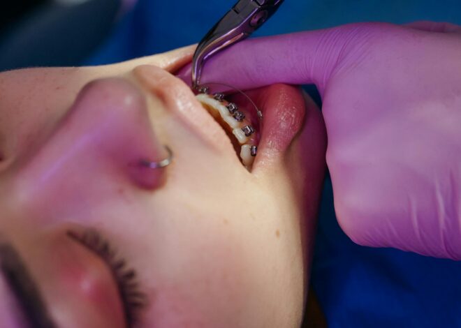 Cum să menții rezultatele albirei dentare pe termen lung